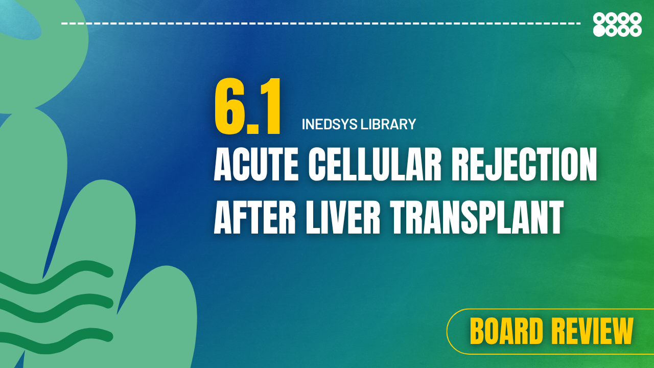 6.1 Acute Cellular Rejection After Liver Transplant